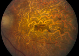 What’s your diagnosis based on the image?